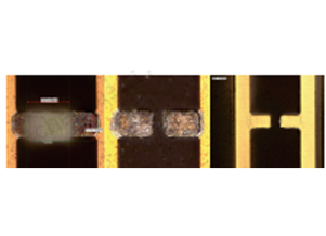 激光修復前→激光除晶后→激光修復后